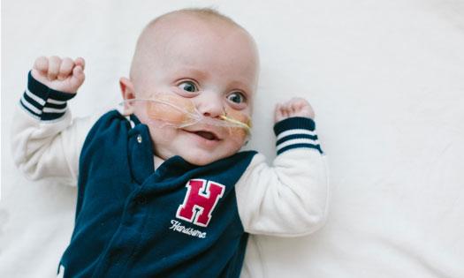 A preemie born at 24 weeks shows a fighting spirit